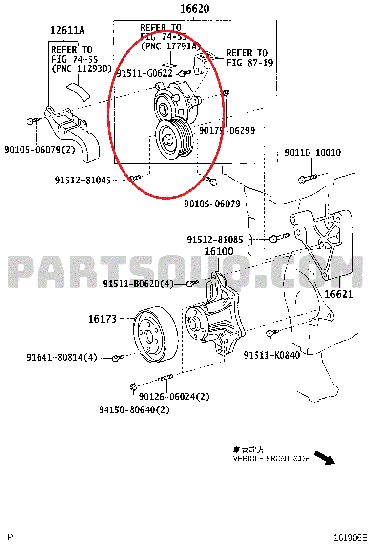 tensioner.gif